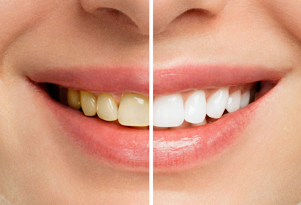 estética dental en Coslada